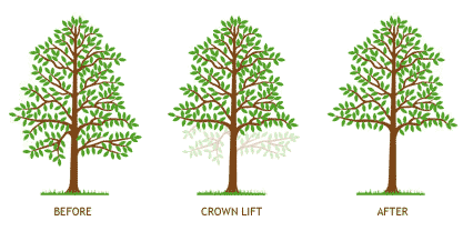 crown lift diagram